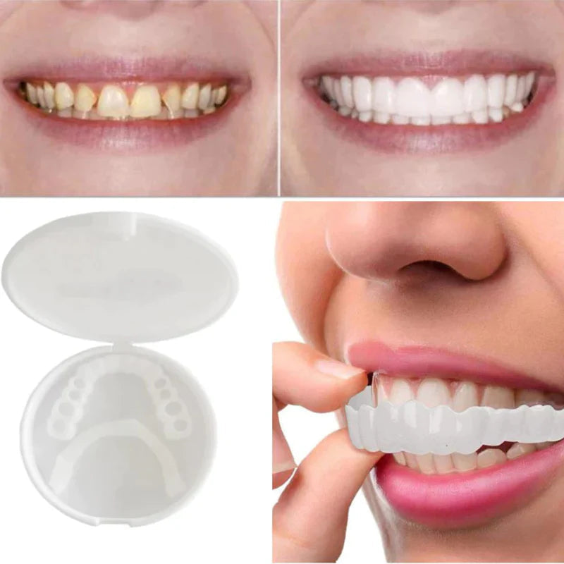 "Facciali dentali bianchi SnapFit, facili da applicare, per un sorriso luminoso senza visite odontoiatriche."