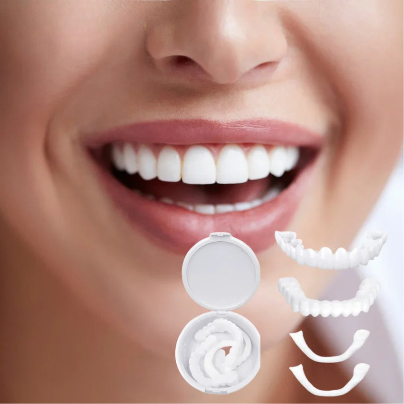 "Facciali dentali bianchi SnapFit, facili da applicare, per un sorriso luminoso senza visite odontoiatriche."