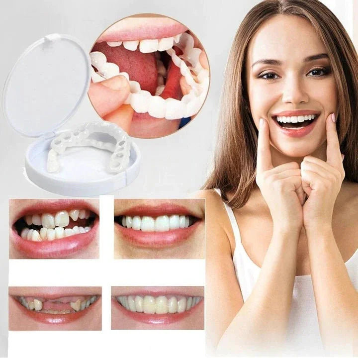 "Faccette dentali Snap-On bianche, migliorano sorriso; denti irregolari o scoloriti coperti per un effetto naturale e radioso