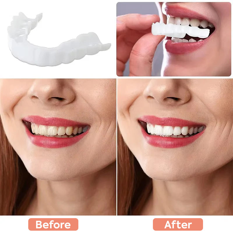 "Faccette dentali unisex clip-on con finitura bianca naturale, aspetto realistico e vestibilità confortevole per sorrisi perf