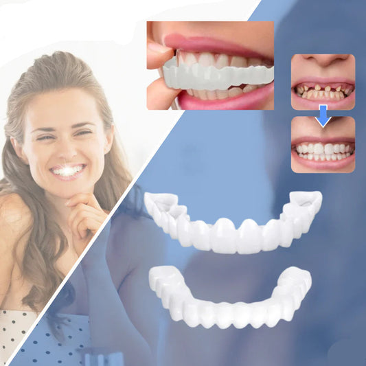 "Facciali dentali bianchi SnapFit, facili da applicare, per un sorriso luminoso senza visite odontoiatriche."