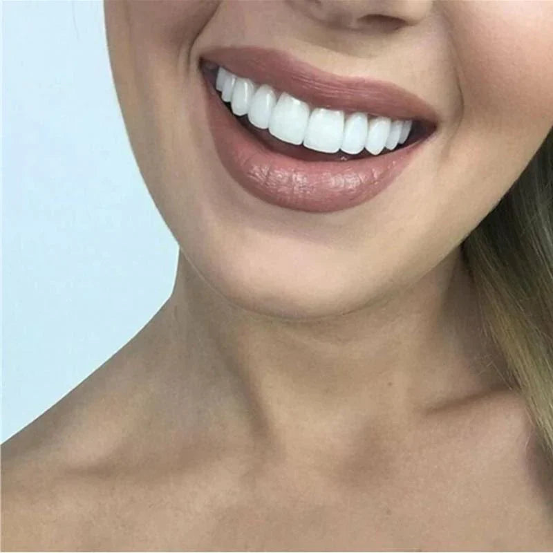 "Facciali dentali bianchi SnapFit, facili da applicare, per un sorriso luminoso senza visite odontoiatriche."