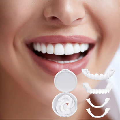 "Facciali dentali bianchi SnapFit, facili da applicare, per un sorriso luminoso senza visite odontoiatriche."