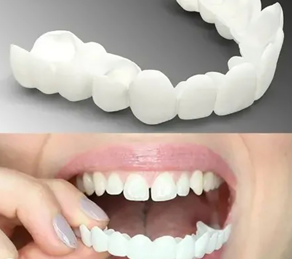 "Protesi dentarie Snap-On regolabili in tono naturale, facili da applicare per migliorare il sorriso senza interventi."
