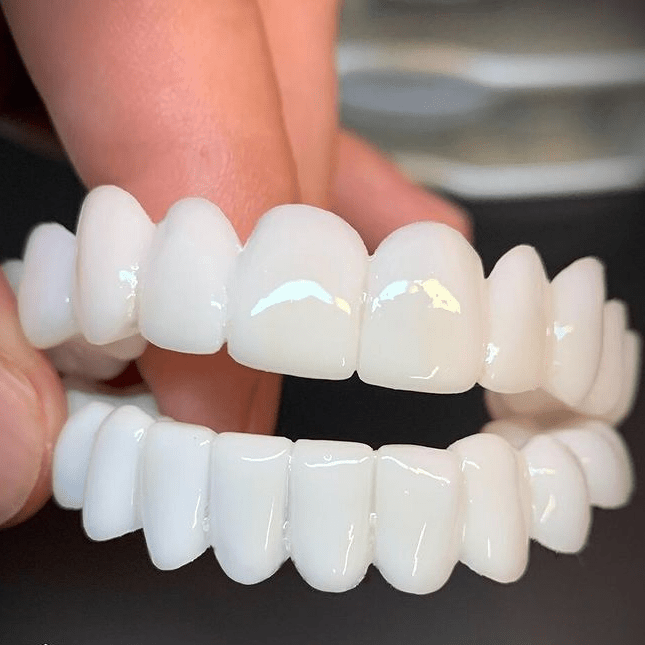 SmileFlex cosmetic tooth covers for instant brightening, achieving a confident, white smile.