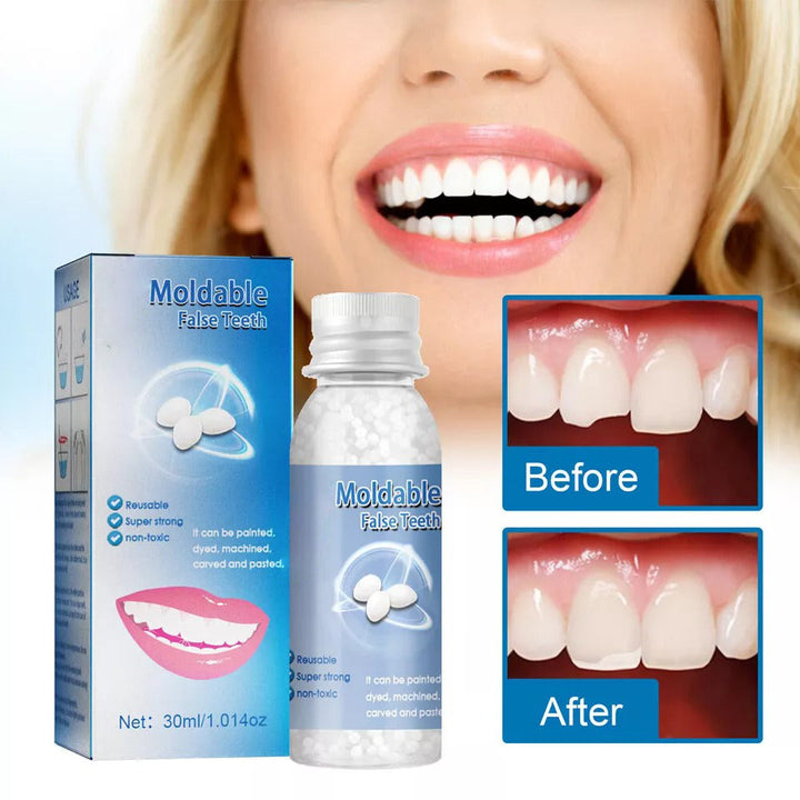 Quick temporary tooth repair kit. Moldable false teeth for instant smile & cosmetic dental solutions.