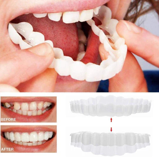 Bright white instant smile veneers. These temporary clip-on cosmetic teeth enhance your smile quickly and easily.